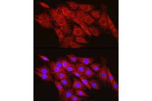 Immunofluorescence analysis of PC-12 cells using CPT2 Rabbit pAb (ABIN6129249, ABIN6138983, ABIN6138984 and ABIN6216045) at dilution of 1:100 (40x lens). (CPT2 anticorps  (AA 1-180))