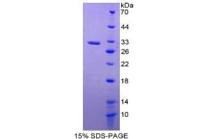 SDS-PAGE (SDS) image for Prostaglandin-Endoperoxide Synthase 1 (Prostaglandin G/H Synthase and Cyclooxygenase) (PTGS1) (AA 367-599) protein (His tag) (ABIN1878775)