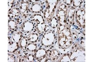 Immunohistochemical staining of paraffin-embedded lung tissue using anti-DAPK2 mouse monoclonal antibody. (DAPK2 anticorps)