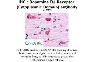 Image no. 1 for anti-Dopamine Receptor D2 (DRD2) (3rd Cytoplasmic Domain) antibody (ABIN1733733) (Dopamine d2 Receptor anticorps  (3rd Cytoplasmic Domain))