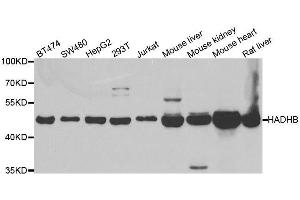 Western blot analysis of extracts of various cell lines, using HADHB antibody. (HADHB anticorps  (AA 34-270))
