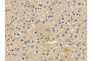 ABIN6258498 and ABIN6274470 at 1/100 staining mouse liver tissue by IHC-P. (ORCTL-2/SLC22A18 anticorps  (C-Term))