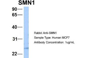 Host: Rabbit Target Name: NOP56 Sample Type: MCF7 Antibody Dilution: 1.