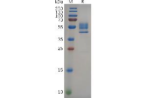 Human TNF Protein, hFc Tag on SDS-PAGE under reducing condition.