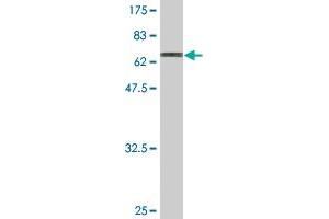 Western Blot detection against Immunogen (70. (Trnt1 anticorps  (AA 1-405))