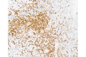 Immunohistochemistry (IHC) image for anti-CD5 (CD5) (AA 445-495) antibody (ABIN7454003) (Recombinant CD5 anticorps  (AA 445-495))