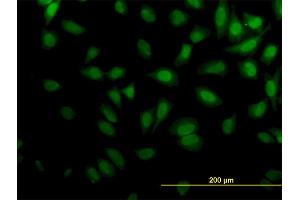 Immunofluorescence of monoclonal antibody to KPTN on HeLa cell.