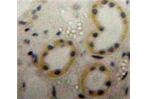 Used in DAB staining on fromalin fixed paraffin-embedded Kidney tissue