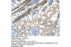 Rabbit Anti-KRT8 Antibody  Paraffin Embedded Tissue: Human Kidney Cellular Data: Epithelial cells of renal tubule Antibody Concentration: 4. (KRT8 anticorps  (N-Term))