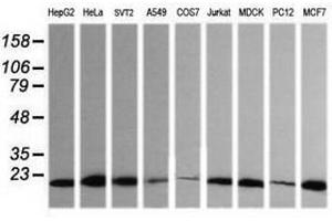 Image no. 2 for anti-HRas proto-oncogene, GTPase (HRAS) antibody (ABIN1498714) (HRAS anticorps)