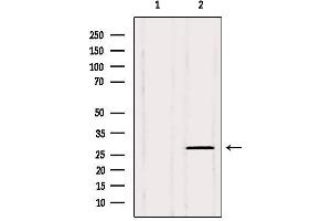 Western blot analysis of extracts from 3t3, using PHF19 Antibody. (PHF19 anticorps  (Internal Region))