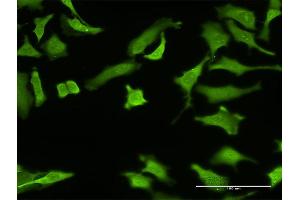 Immunofluorescence of monoclonal antibody to ZNF287 on HeLa cell.