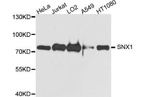Western blot analysis of extract of various cells, using SNX1 antibody. (Sorting Nexin 1 anticorps)