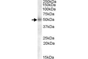 GCNT3 polyclonal antibody  (0. (GCNT3 anticorps  (AA 273-284))