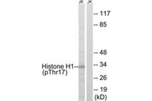 Western blot analysis of extracts from Jurkat cells treated with UV 15', using Histone H1 (Phospho-Thr17) Antibody. (Histone H1 anticorps  (pSer17))