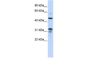 WB Suggested Anti-ZNF765 Antibody Titration:  0. (ZNF765 anticorps  (N-Term))