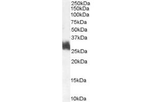 Image no. 1 for anti-FOS-Like Antigen 1 (FOSL1) (Internal Region) antibody (ABIN374695) (FOSL1 anticorps  (Internal Region))