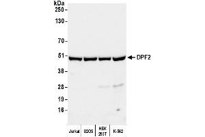 Western Blotting (WB) image for anti-Zinc finger protein ubi-d4 (DPF2) (AA 125-175) antibody (ABIN7451434) (DPF2 anticorps  (AA 125-175))