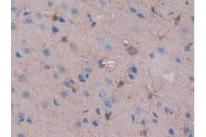 IHC-P analysis of Mouse Cerebrum Tissue, with DAB staining. (SLIT1 anticorps  (AA 3-211))
