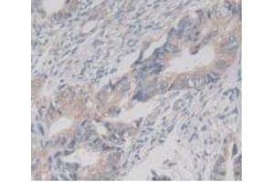 Figure. (TMEM27 anticorps  (AA 17-137))