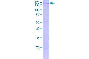 Image no. 1 for Trimethylguanosine Synthase 1 (TGS1) (AA 1-853) protein (GST tag) (ABIN1322652)