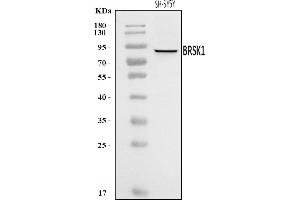Western blot analysis of BRSK1 using anti-BRSK1 antibody (ABIN7600990).