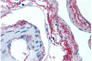Human Skeletal Muscle, Vessels (formalin-fixed, paraffin-embedded) stained with ELN antibody ABIN305753 at 5 ug/ml followed by biotinylated anti-mouse IgG secondary antibody ABIN481714, alkaline phosphatase-streptavidin and chromogen.