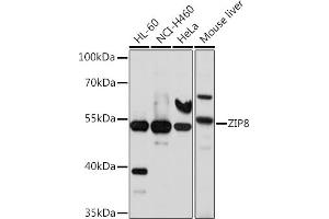Western blot analysis of extracts of various cell lines, using ZIP8 antibody (ABIN6131079, ABIN6147995, ABIN6147996 and ABIN6214638) at 1:1000 dilution. (SLC39A8 anticorps  (AA 180-300))