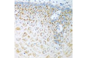 Immunohistochemistry of paraffin-embedded human esophagus using FDXR antibody (ABIN5972045) at dilution of 1/100 (40x lens). (Ferredoxin Reductase anticorps)