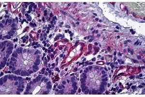 Anti-PPP3CA / Calcineurin A antibody IHC of human small intestine.
