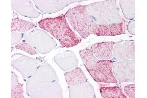 Anti-PTPRA antibody IHC of human skeletal muscle.