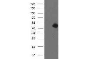 Western Blotting (WB) image for anti-Pre-B-Cell Leukemia Homeobox Protein 1 (PBX1) antibody (ABIN1500046) (PBX1 anticorps)