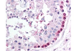 Anti-PINK1 antibody IHC of human testis.