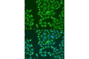 Immunofluorescence analysis of U2OS cells using ST antibody  at dilution of 1:100.