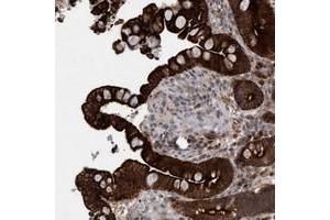 Immunohistochemical staining of human colon with GARNL4 polyclonal antibody  shows strong cytoplasmic, membranous and nuclear positivity in glandular cells at 1:50-1:200 dilution. (RAP1GAP2 anticorps)