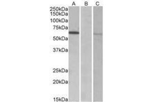 Image no. 1 for anti-Makorin Ring Finger Protein 1 (MKRN1) (AA 105-118) antibody (ABIN1103034) (MKRN1 anticorps  (AA 105-118))