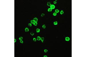 IHC analysis of Cyclophilin A using anti-Cyclophilin A antibody .
