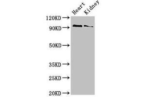 Western Blot Positive WB detected in: Mouse heart tissue, Mouse kidney tissue All lanes: VPS39 antibody at 3 μg/mL Secondary Goat polyclonal to rabbit IgG at 1/50000 dilution Predicted band size: 102, 101 kDa Observed band size: 102 kDa (VPS39 anticorps  (AA 263-490))