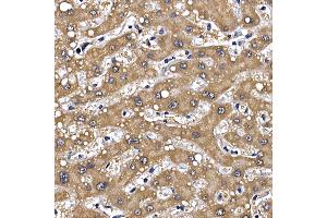 Immunohistochemistry of paraffin-embedded human liver using GFR Rabbit pAb (ABIN6127950, ABIN6141065, ABIN6141066 and ABIN6221017) at dilution of 1:100 (40x lens). (GFRA1 anticorps  (AA 25-280))