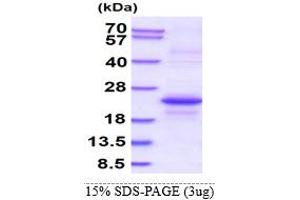 SDS-PAGE (SDS) image for CD7 (CD7) (AA 26-180) protein (His tag) (ABIN5853191)