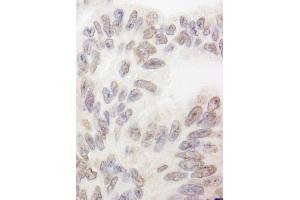 anti-RNA Binding Motif Protein 12 (RBM12) (AA 625-675) antibody