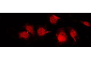 ABIN6269008 staining Hela by IF/ICC. (GLUT1 anticorps  (C-Term))