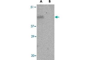 Western blot analysis of PDCD1 in THP-1 cell lysate with PDCD1 polyclonal antibody  at 1 ug/mL in the (A) absence and (B) presence of blocking peptide.