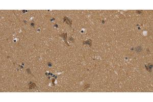 Immunohistochemistry of paraffin-embedded Human brain using PUS10 Polyclonal Antibody at dilution of 1:45 (PUS10 anticorps)