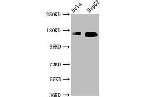 Western Blot Positive WB detected in: Hela whole cell lysate, HepG2 whole cell lysate All lanes: TMF1 antibody at 3. (TMF1 anticorps  (AA 878-986))