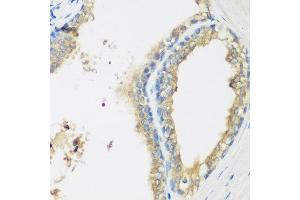 Immunohistochemistry of paraffin-embedded human prostate using WDR77 antibody at dilution of 1:200 (40x lens). (WDR77 anticorps)