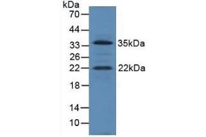 Detection of IGF1 in Mouse Heart Tissue using Polyclonal Antibody to Insulin Like Growth Factor 1 (IGF1) (IGF1 anticorps  (AA 49-153))