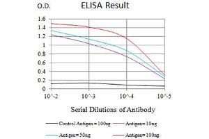 Black line: Control Antigen (100 ng),Purple line: Antigen (10 ng), Blue line: Antigen (50 ng), Red line:Antigen (100 ng)