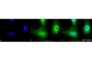 Immunocytochemistry/Immunofluorescence analysis using Rabbit Anti-Calreticulin Polyclonal Antibody . (Calreticulin anticorps  (HRP))