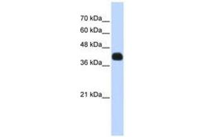 Image no. 1 for anti-ISL LIM Homeobox 2 (ISL2) (N-Term) antibody (ABIN6740633) (ISL2 anticorps  (N-Term))